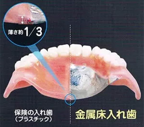 implant1-16